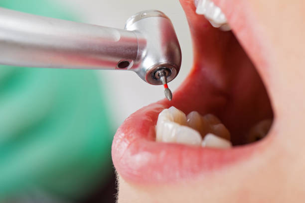 Best Walk-In Emergency Dental Services in Rhome, TX